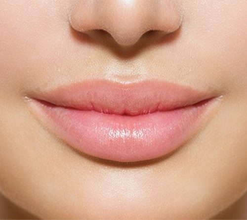 Lip fillers